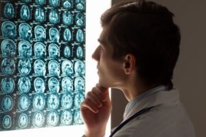 A doctor looking at the brain injury result of a patient in Boulder.